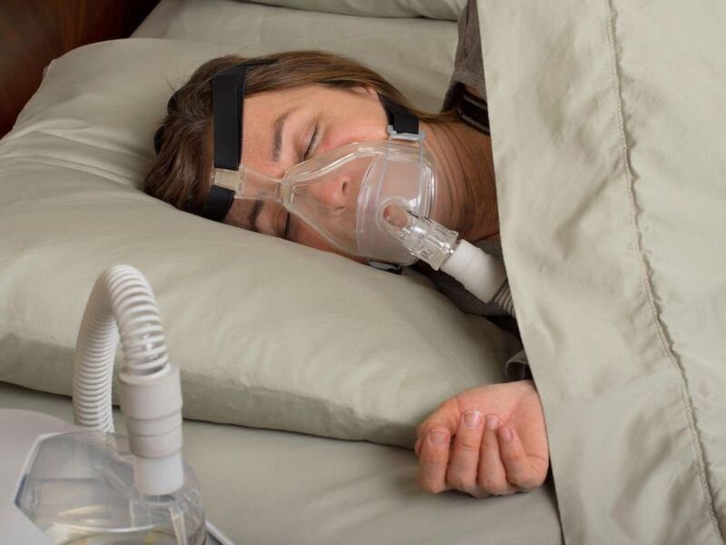 sleep-apnea-patients