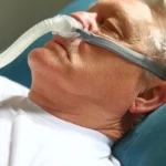 Sleep Apnea